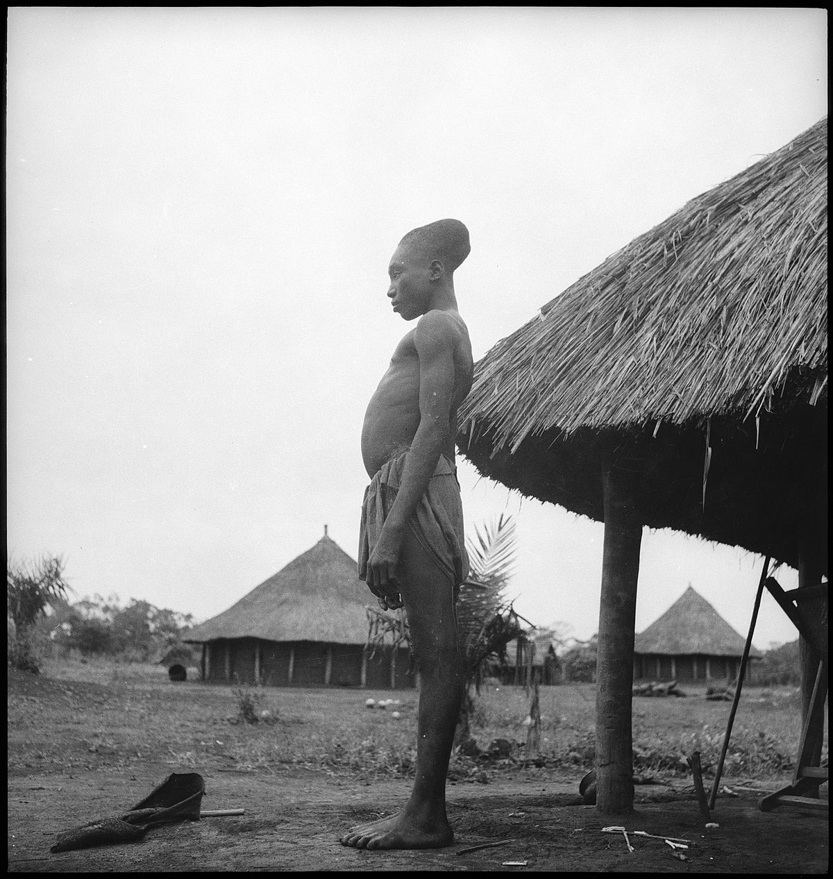 Belgisch-Kongo, Niangara: Menschen; Junger Mann des Stammes Mangbetu mit künstlich verlängertem Schädel steht in der Seitenansicht